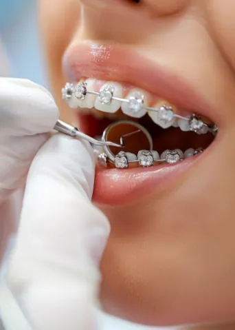 Orthodontics